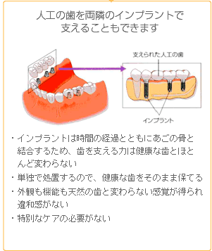 lH̎𗼗ׂ̃CvgŎx邱Ƃł܂